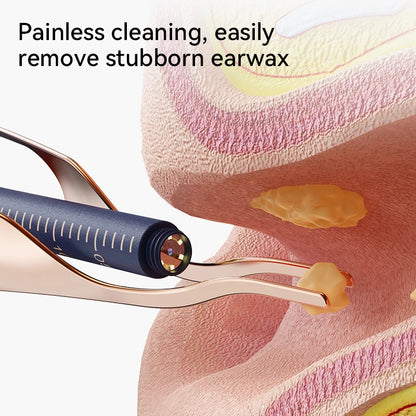 Smart HD Visual Ear Cleaner