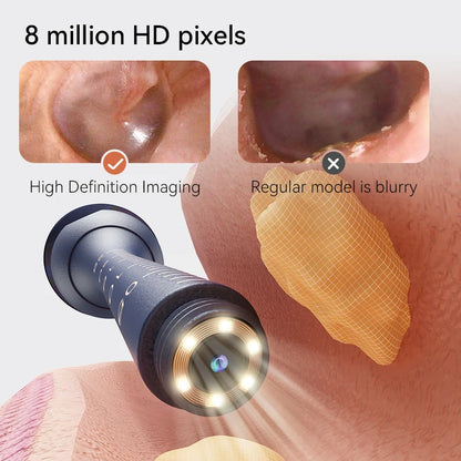 Smart HD Visual Ear Cleaner