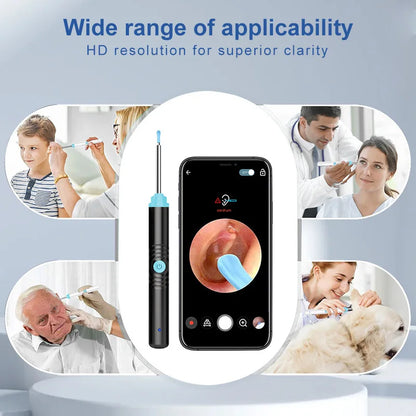 Precision HD Visual Ear Cleaner